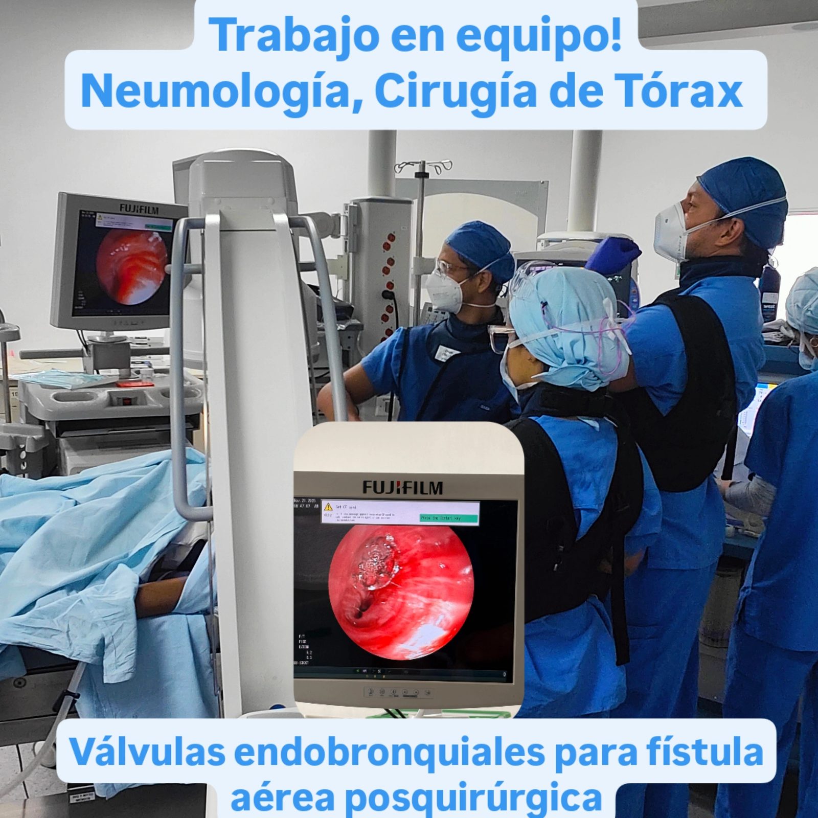 Implantación de válvulas endobronquiales